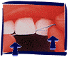 floss_b.gif (11524 bytes)