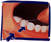 floss_d.gif (13697 bytes)