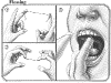 flossing_tech.gif (17745 bytes)